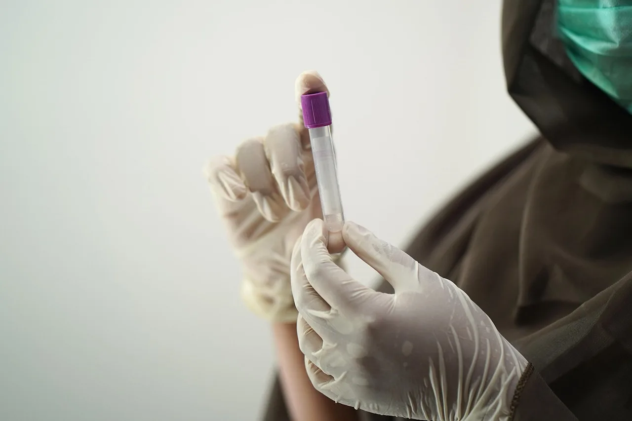 Próbówka z krwią do badania cholesterolu — lipidogram w laboratorium